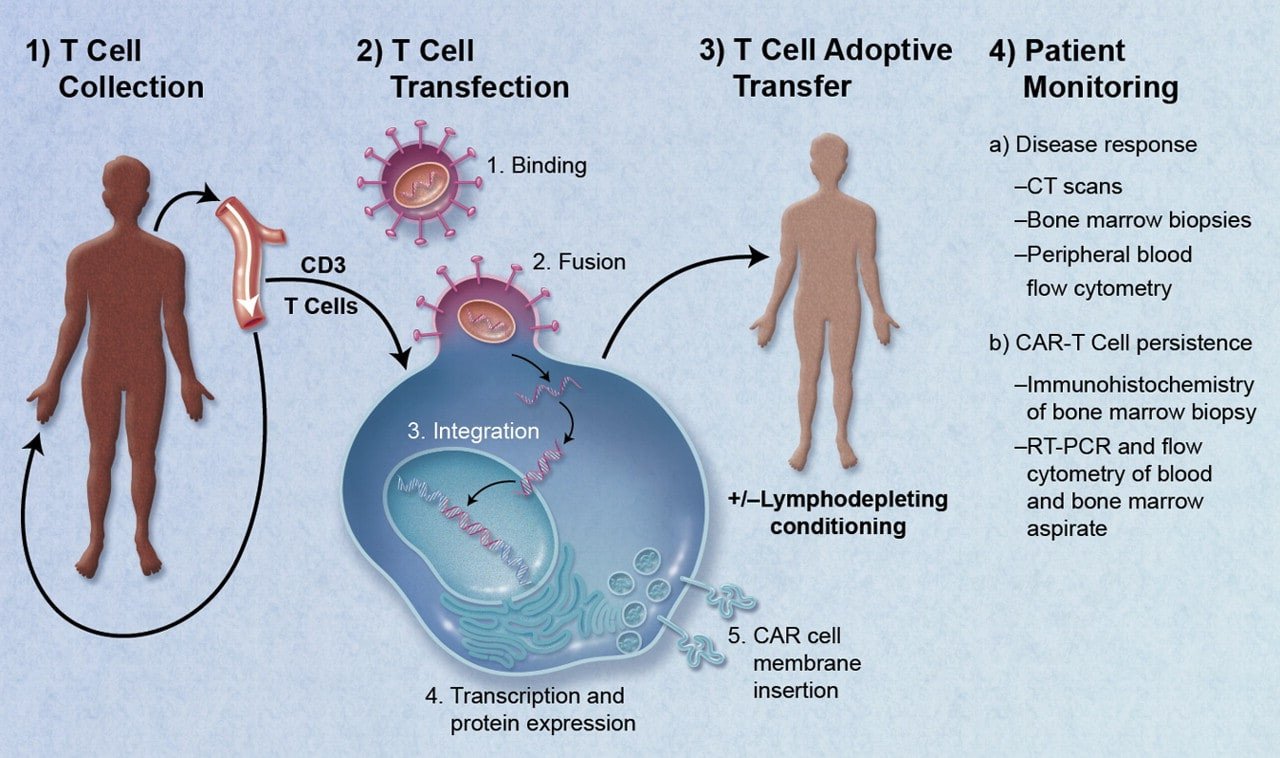 Esquema da terapia com células T com receptor de antígeno quimérico (CAR-T)