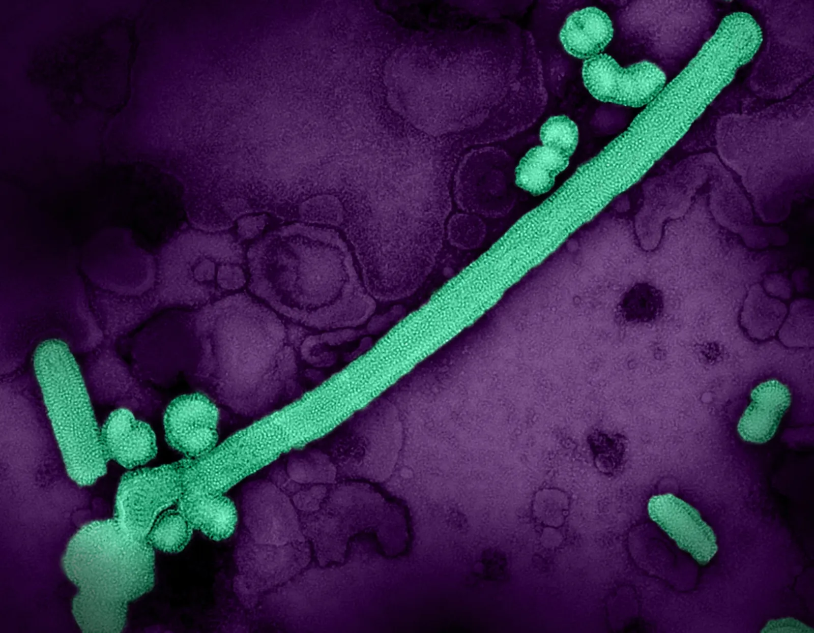 Partículas de vírus influenza A (H3N2) em microscopia