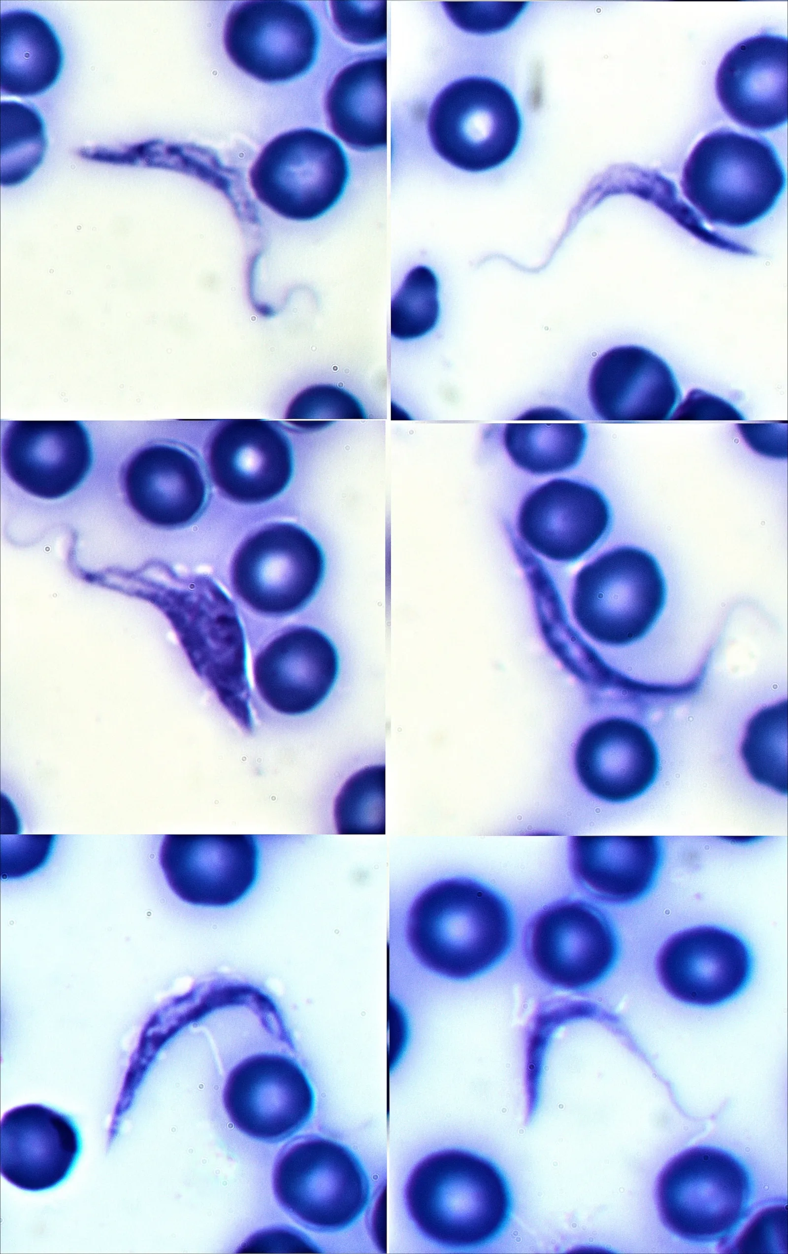 Trypanosoma cruzi, o parasita causador da doença de Chagas, em esfregaço de sangue ao microscópio